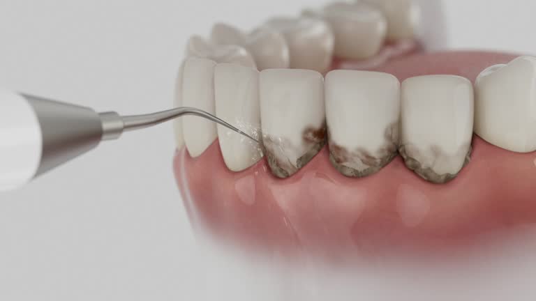 Reliable Dental contractor in Payson, IL by Smile Center Dentistry